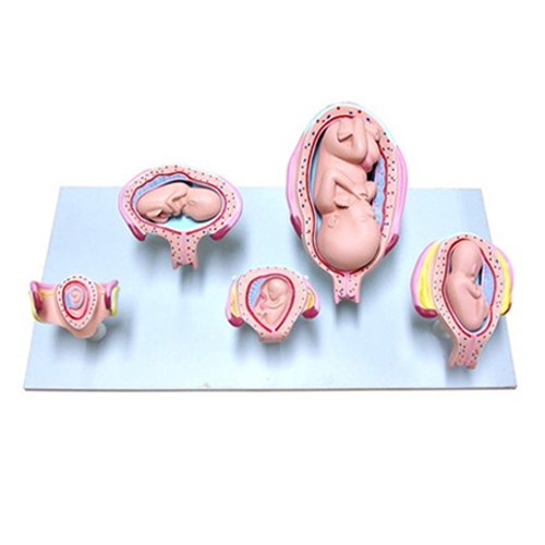 상품 섬네일